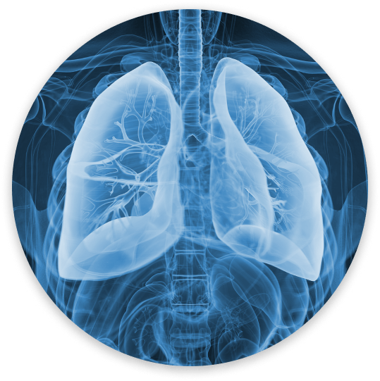 Lunge Röntgenbild
